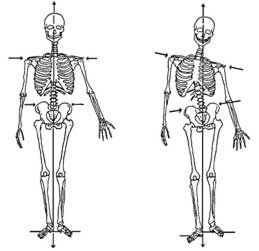 skeleton alignment and misalignment hips and pelvis