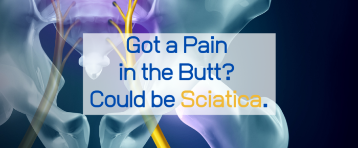 Got a Pain in the Butt? Could be Sciatica.